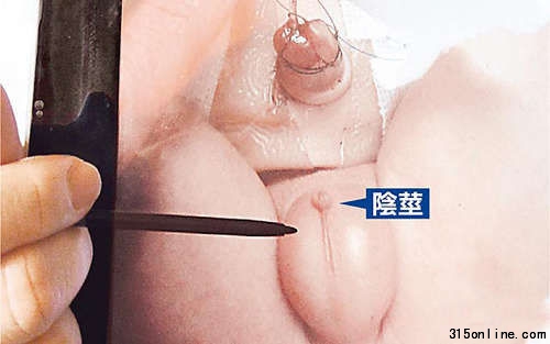 男嬰生殖器約0.2厘米長(zhǎng)(筆指處),一粒米大小,不到平均長(zhǎng)度2.9厘米的十分之一。圖片來(lái)源:臺(tái)灣媒體 男嬰生殖器約0.2厘米長(zhǎng)(筆指處),一粒米大小,不到平均長(zhǎng)度2.9厘米的十分之一。圖片來(lái)源:臺(tái)灣媒體